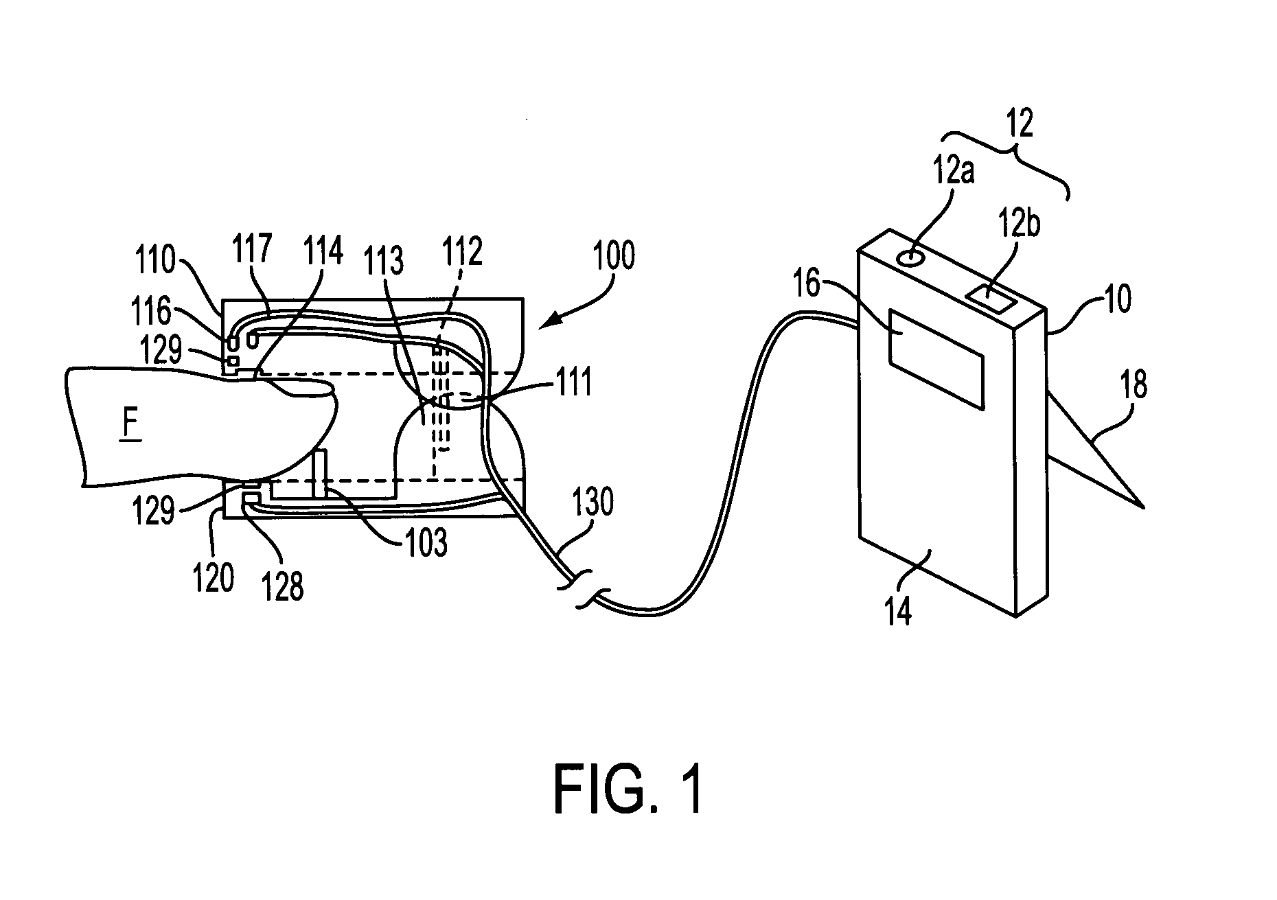 Low-cost method and apparatus for non-invasively measuring blood glucose levels