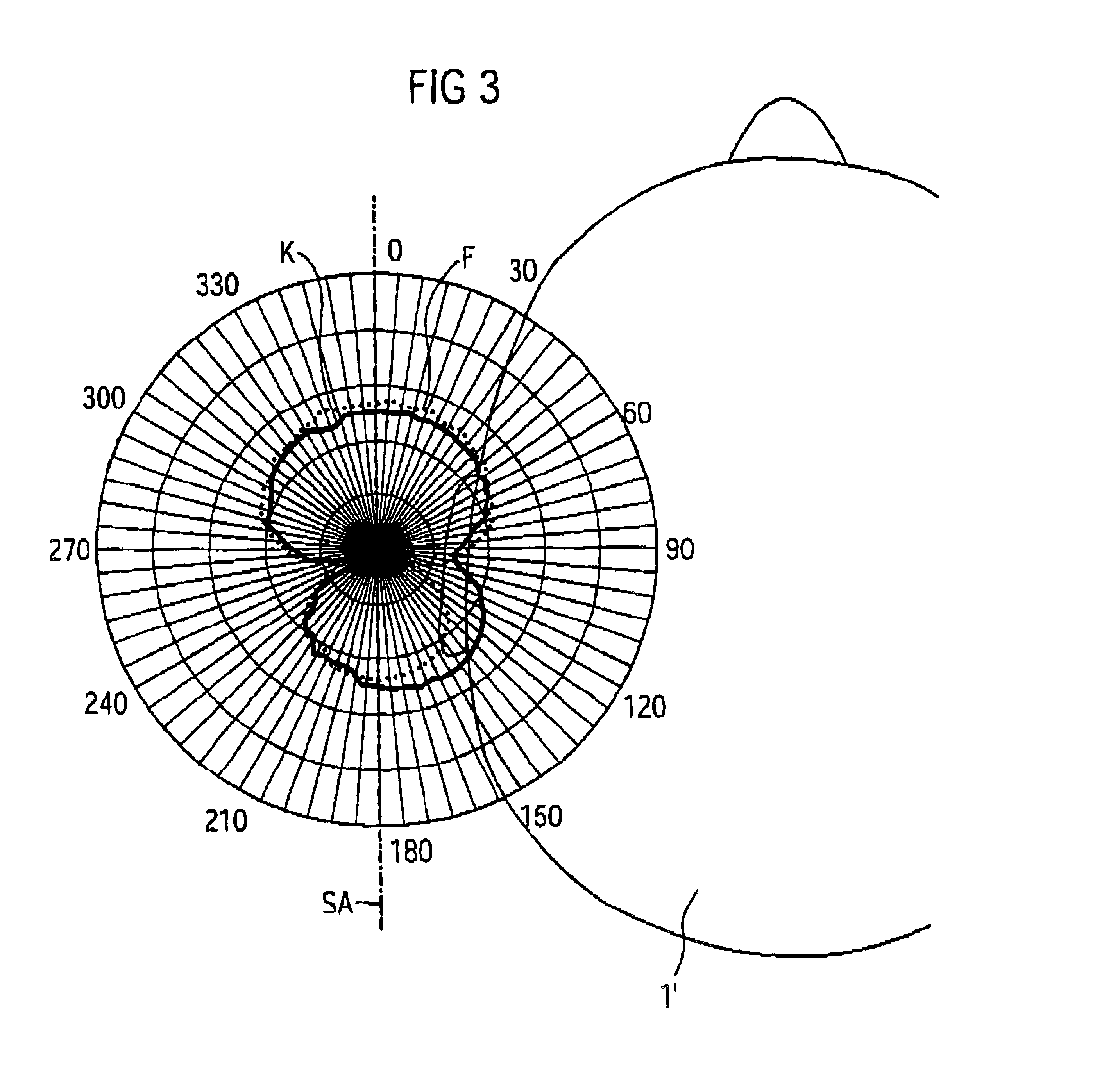 Method and apparatus for suppressing an acoustic interference signal in an incoming audio signal