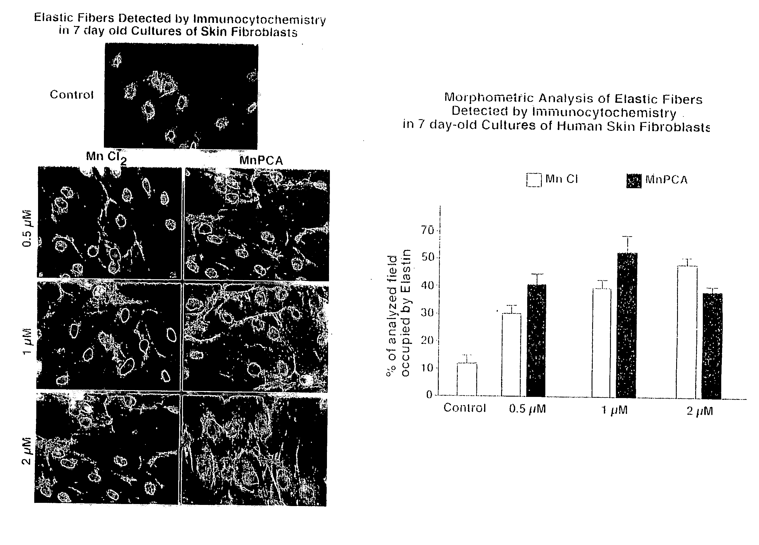 Compositions for elastrogenesis and connective tissue treatment
