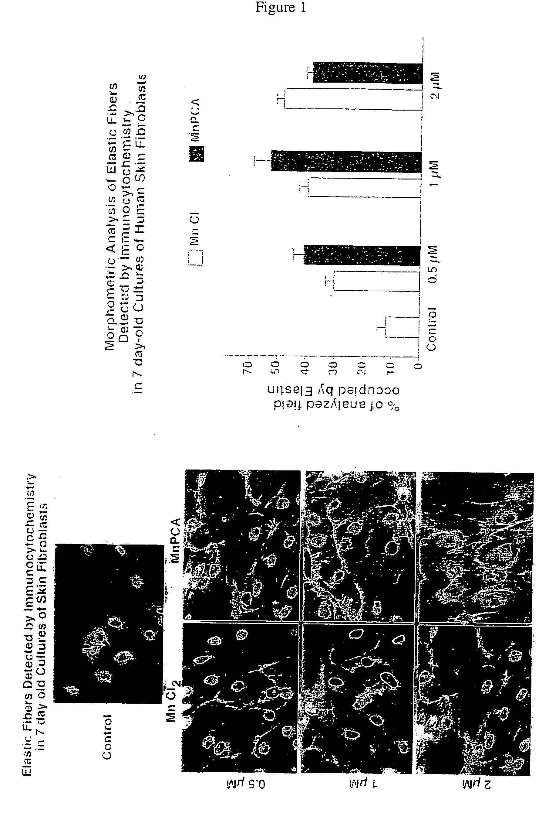 Compositions for elastrogenesis and connective tissue treatment