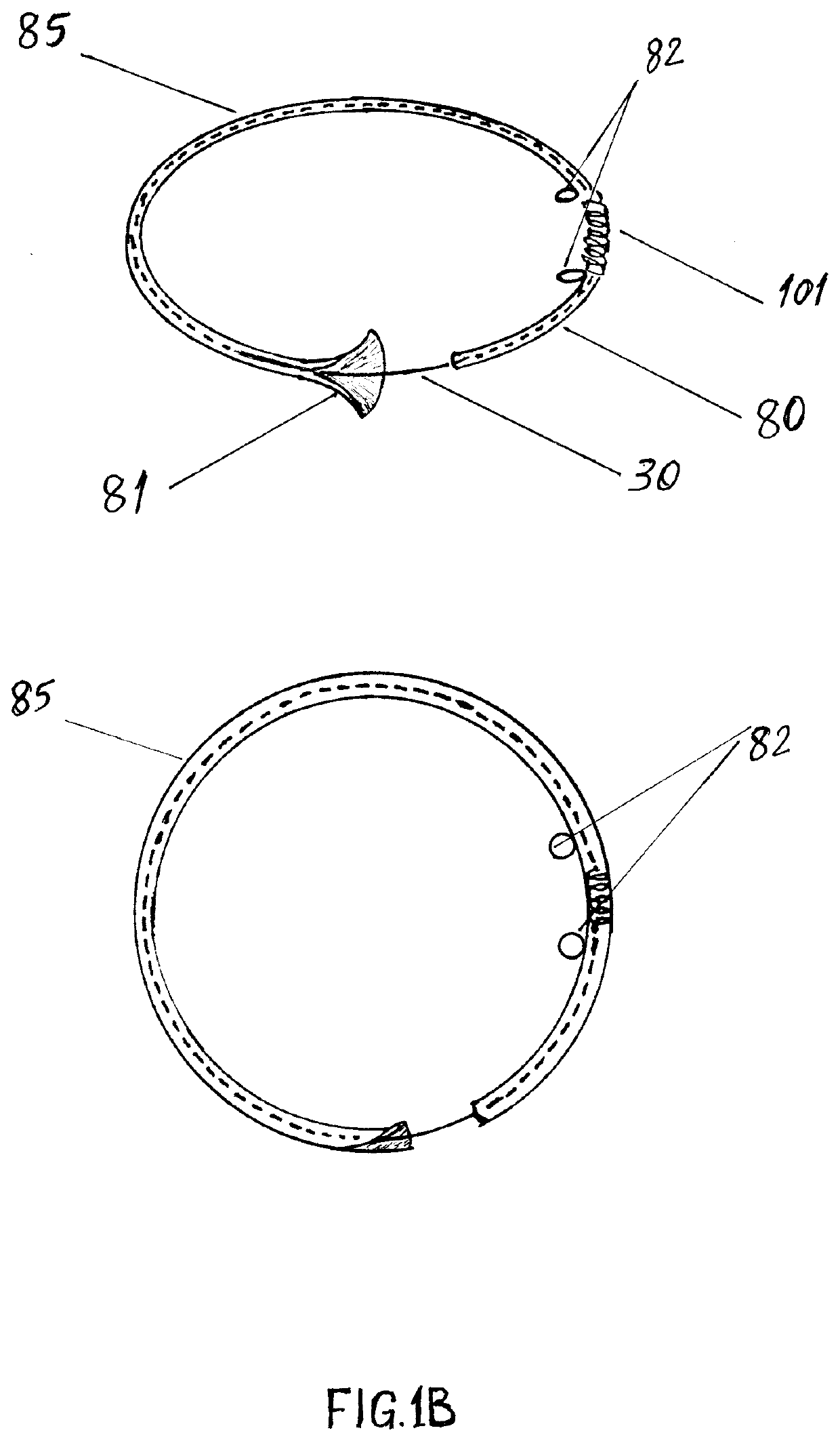 Splatter control apparatus with tension ring and method