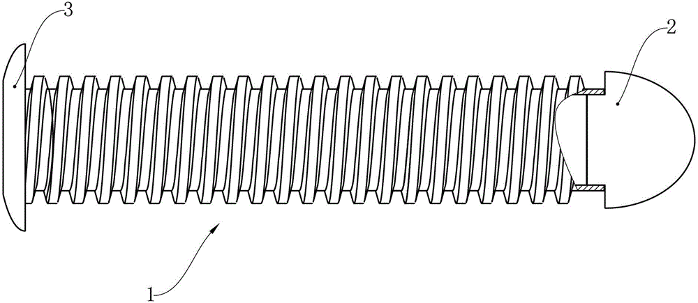 Nerve spacer in centrum