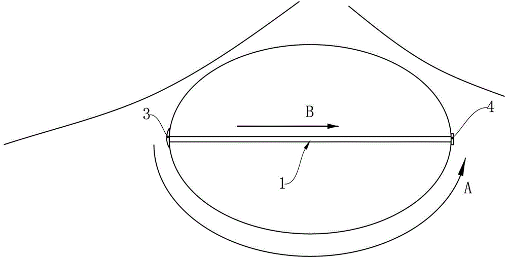 Nerve spacer in centrum