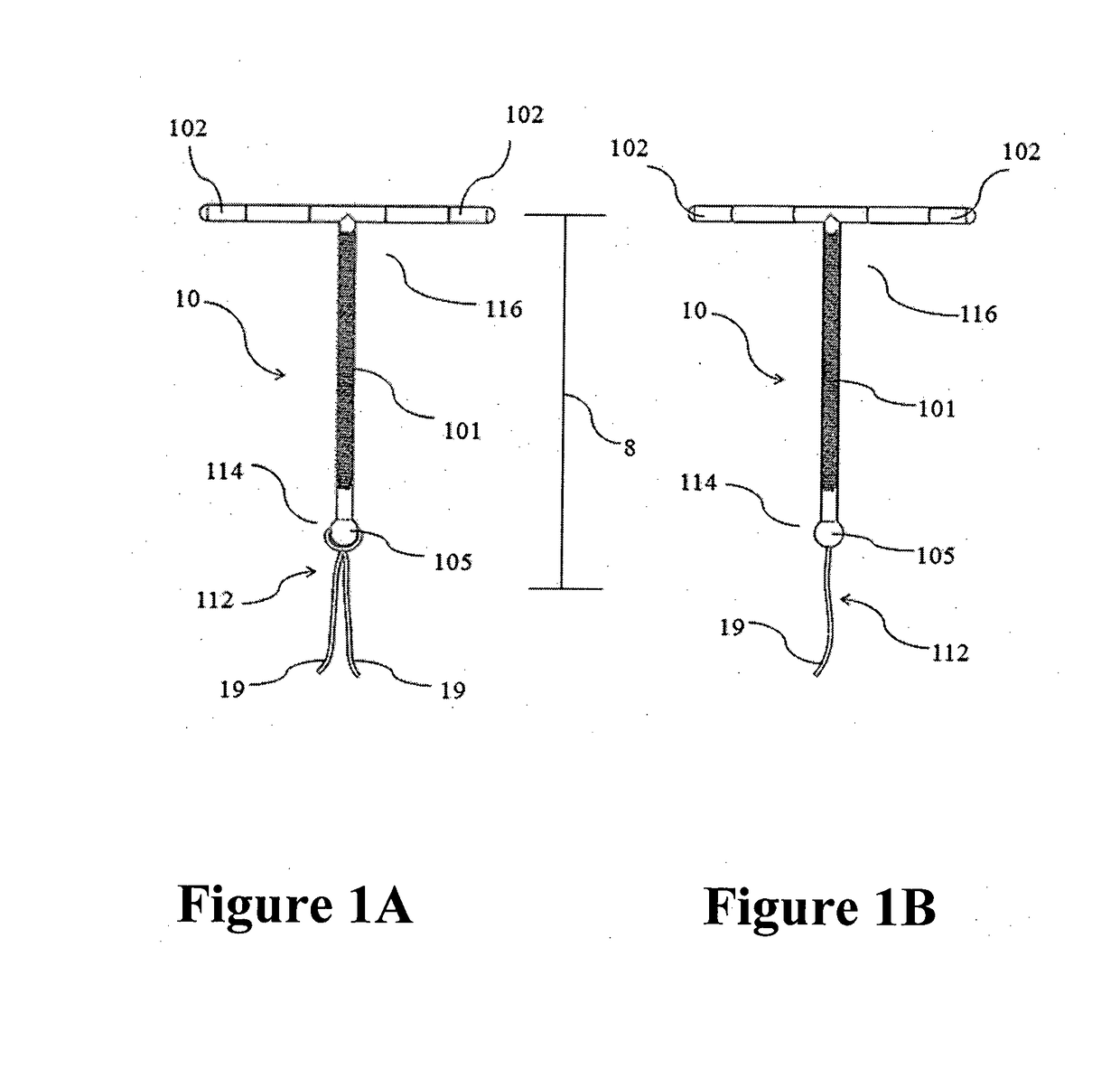 Intrauterine device with a restricted upward movement of a string