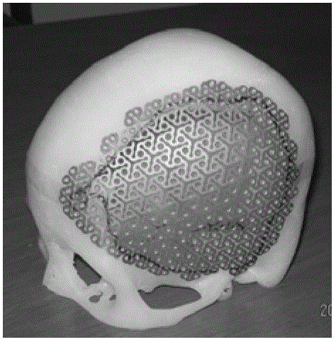 Bionic design method of skull tissue engineering scaffold