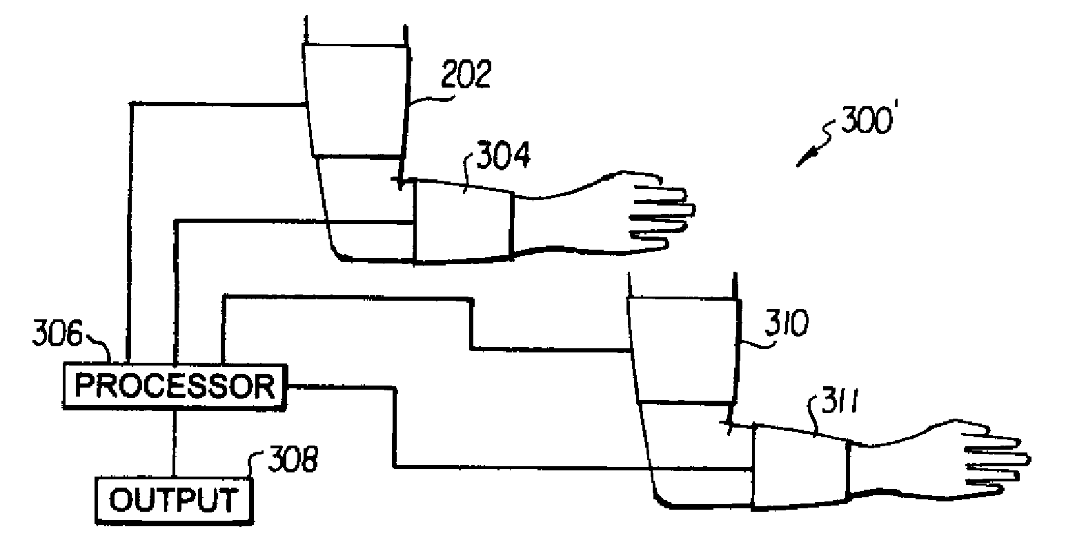 Impedance based device for non-invasive measurement of blood pressure and ankle-brachial index