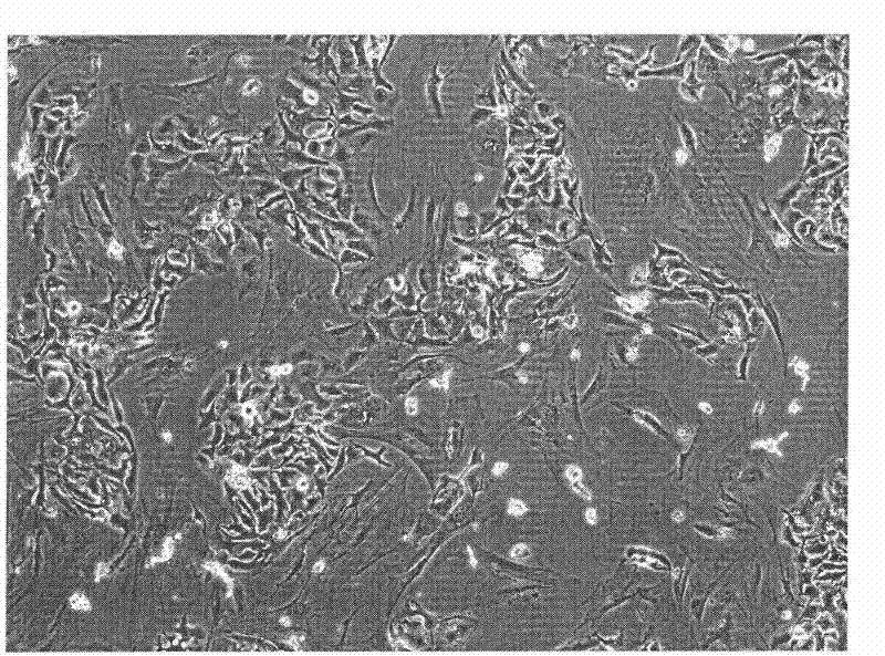 Human hepatocellular carcinoma cell line with portal vein transfer potential