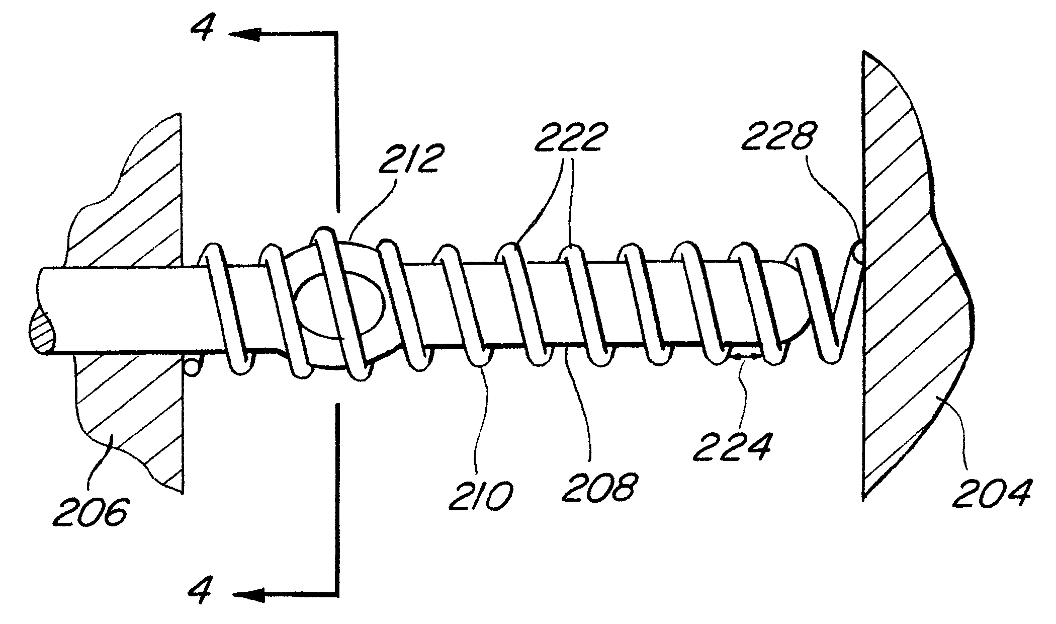Electrical connection to a coil spring through a local interference fit for connection to a vibratory rotation sensor and method of forming the same