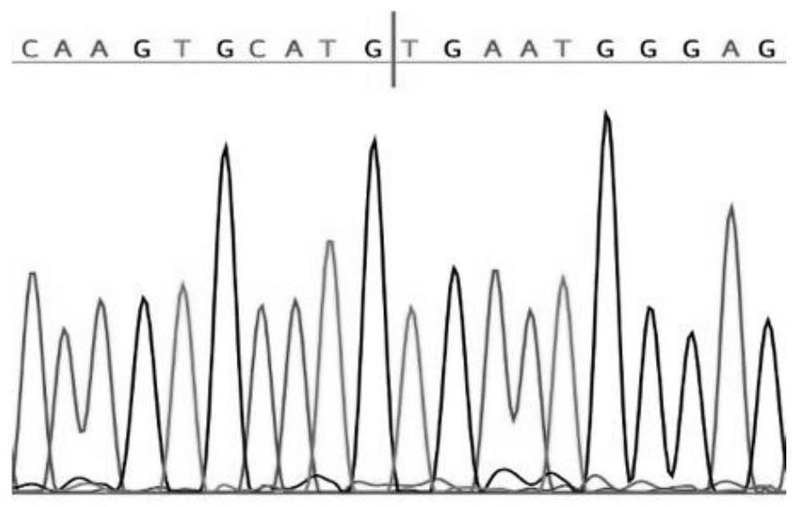 Cyclic RNA (Ribonucleic Acid) biomarker for breast cancer and application of circular RNA biomarker