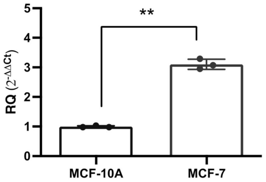 Cyclic RNA (Ribonucleic Acid) biomarker for breast cancer and application of circular RNA biomarker