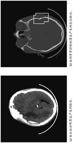 Application of deep learning for medical imaging evaluation