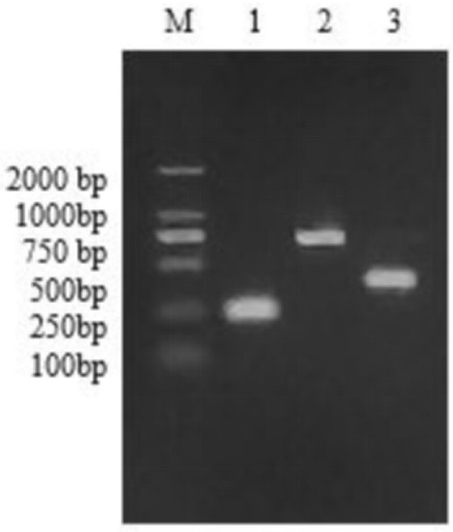 Turbot-derived Streptococcus parauberis and application thereof