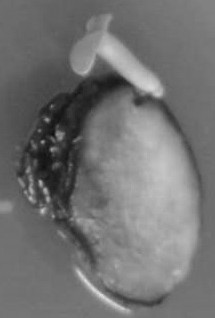 Method for rapidly propagating akebia trifoliata varaustralis seedlings through somatic embryogenesis pathway