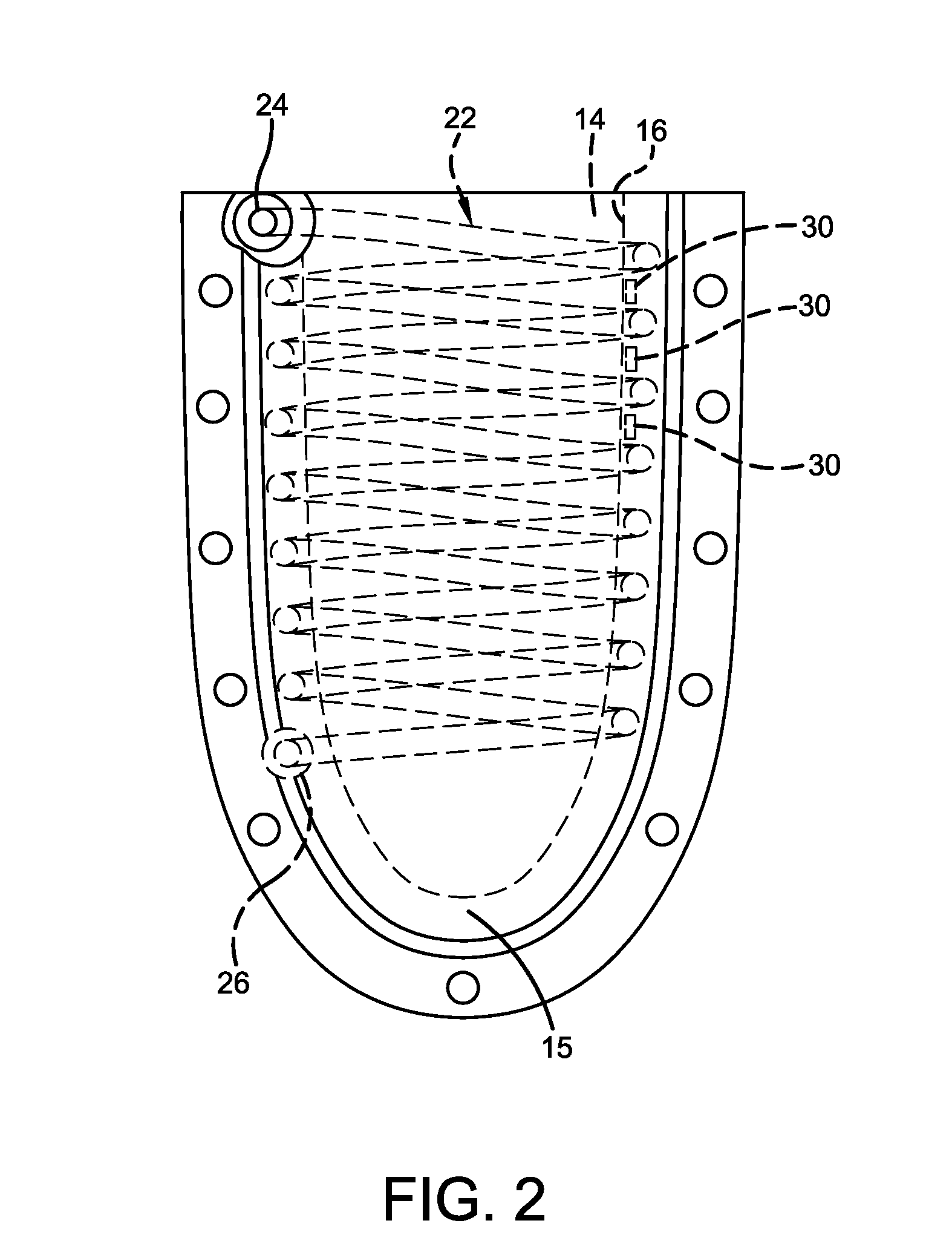 Prosthetic socket with integrated cooling channels