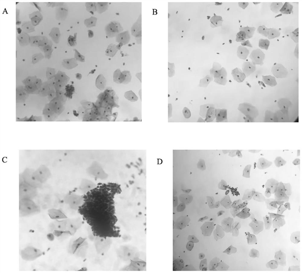 A kind of cell preservation liquid and its preparation method and application