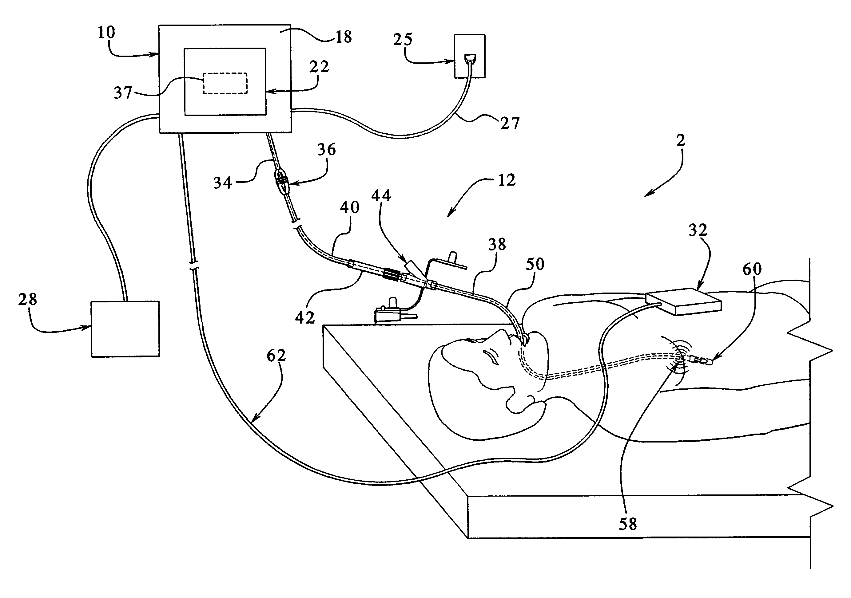 Tubing assembly and signal generator placement control device and method for use with catheter guidance systems