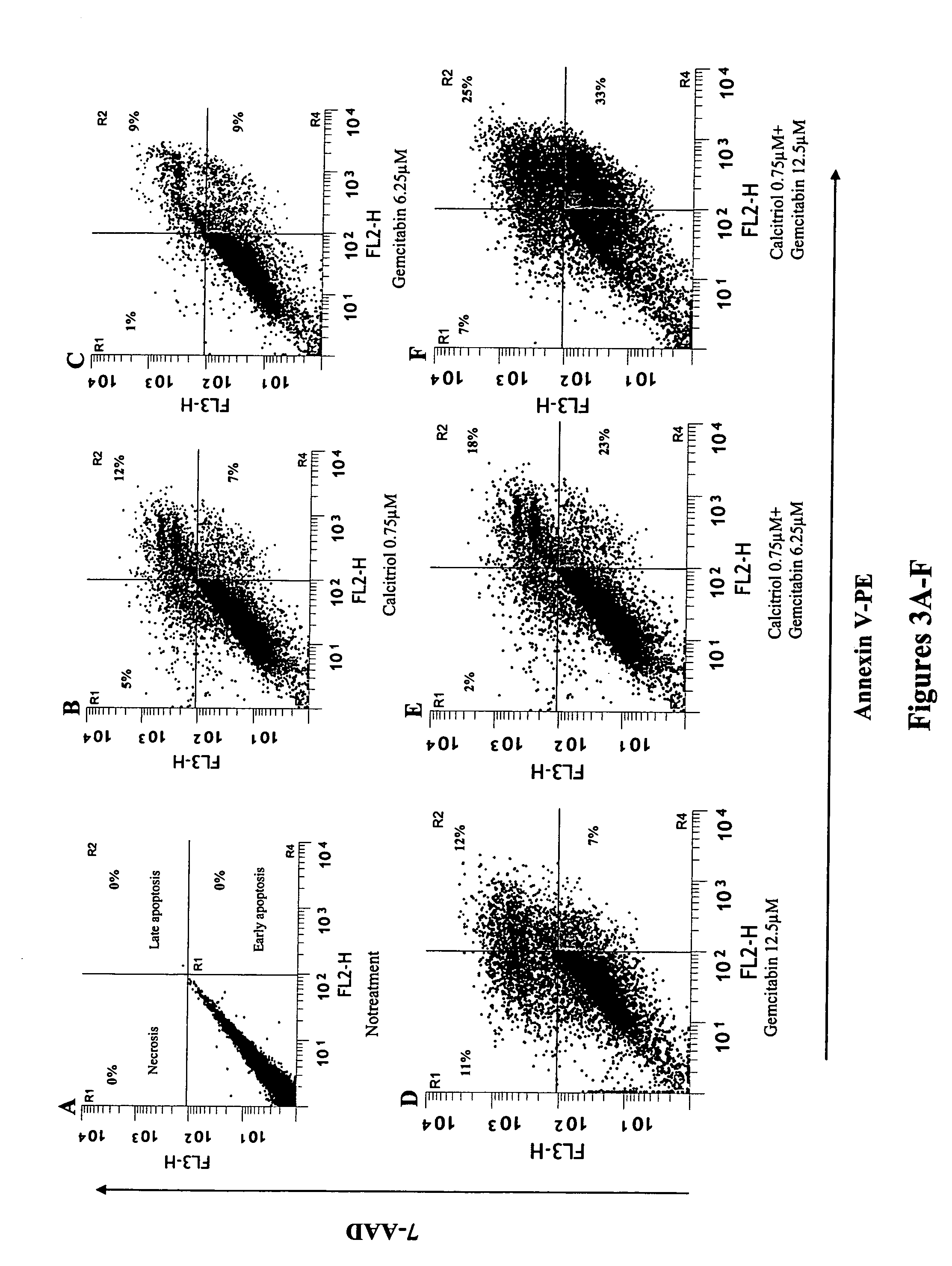 Method of treating solid tumors and leukemias using combination therapy of vitamin D and anti-metabolic nucleoside analogs
