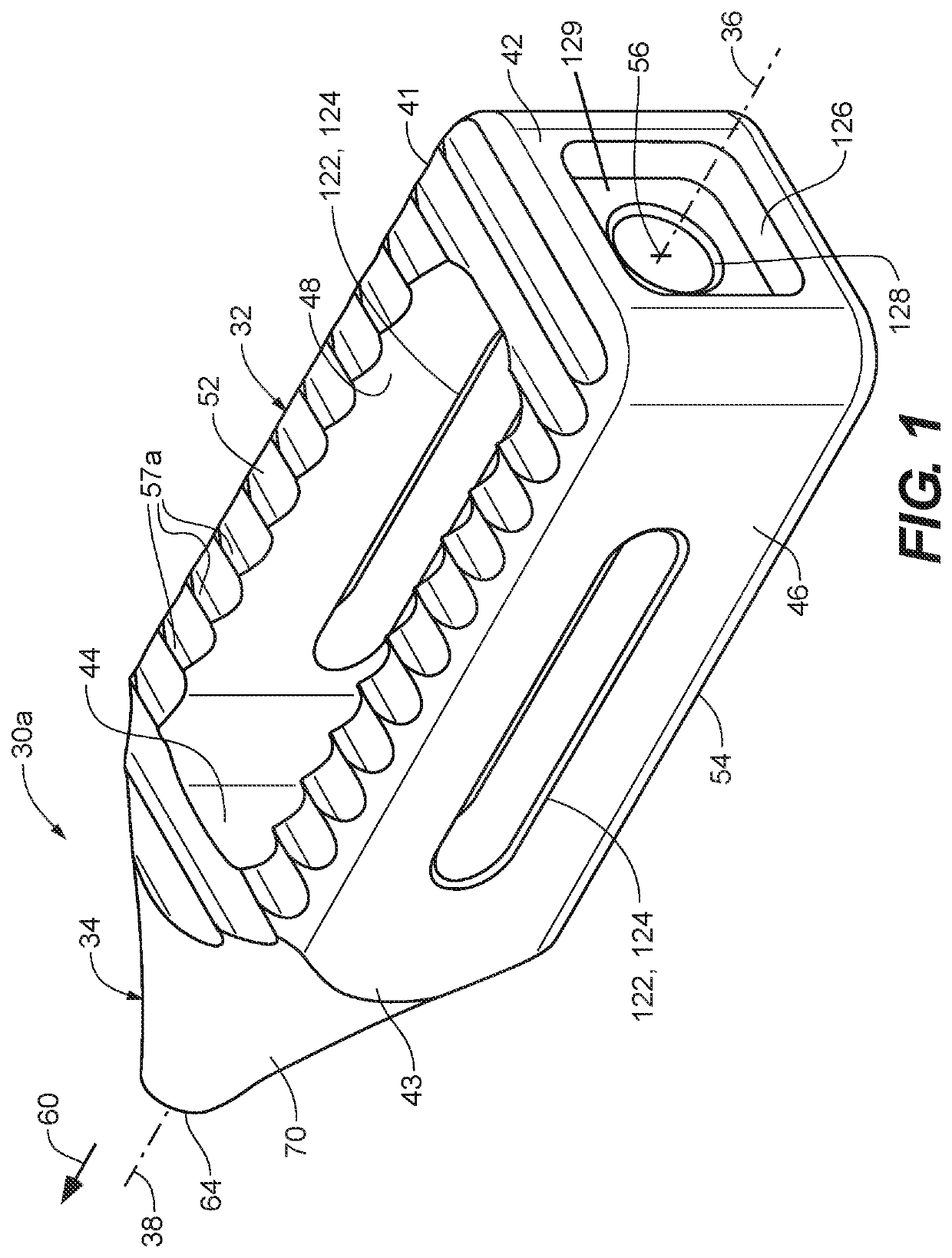 Interbody implant with concave profiled nose