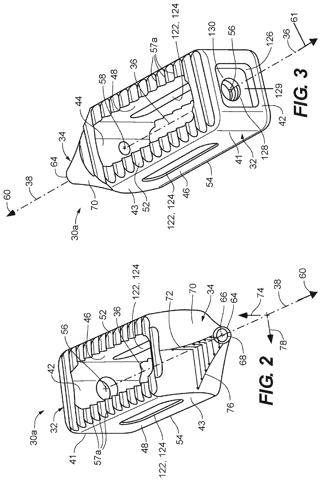 Interbody implant with concave profiled nose