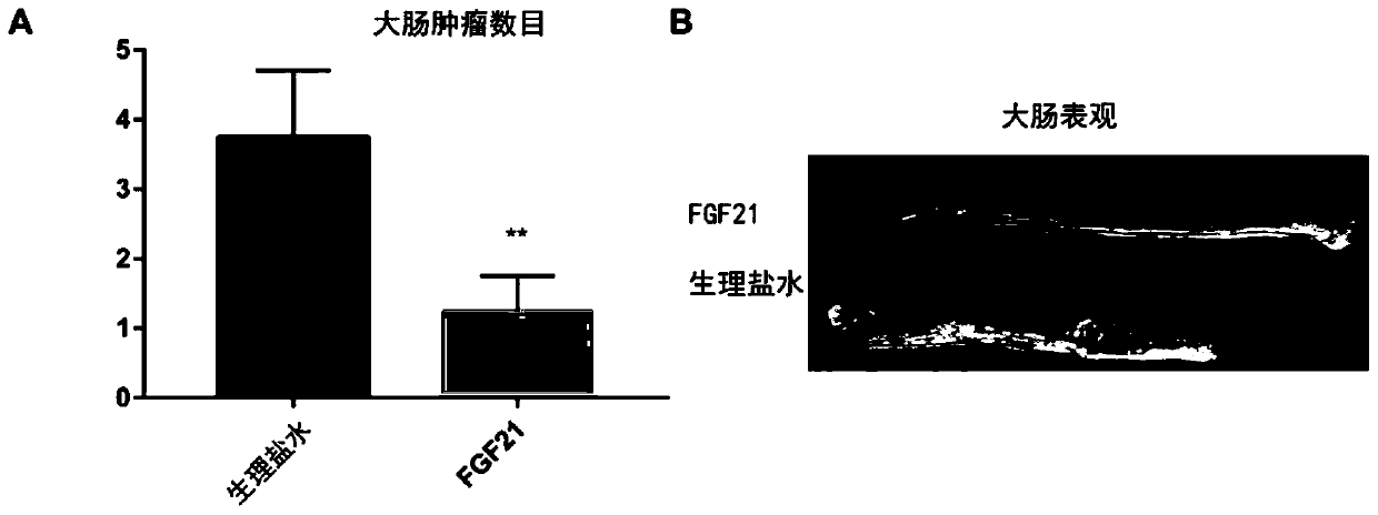 Application of FGF21 in preparation of medicine for treating colorectal cancer