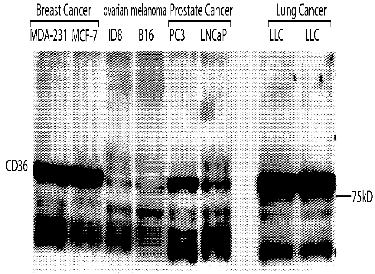 Use of cd36 to identify cancer subjects for treatment