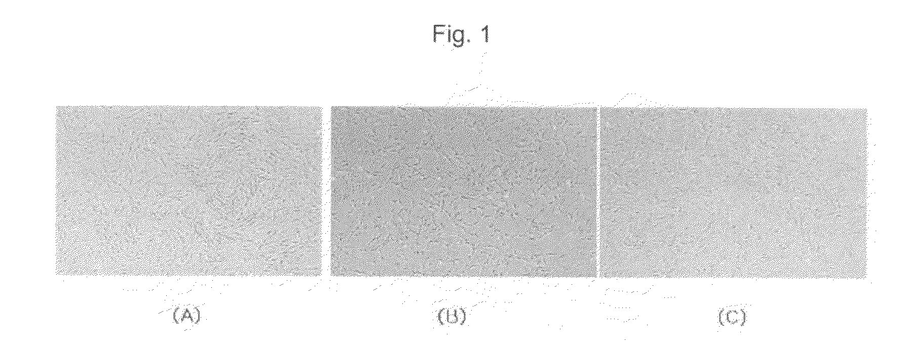 Neuronal differentiation method of adult stem cells using small molecules