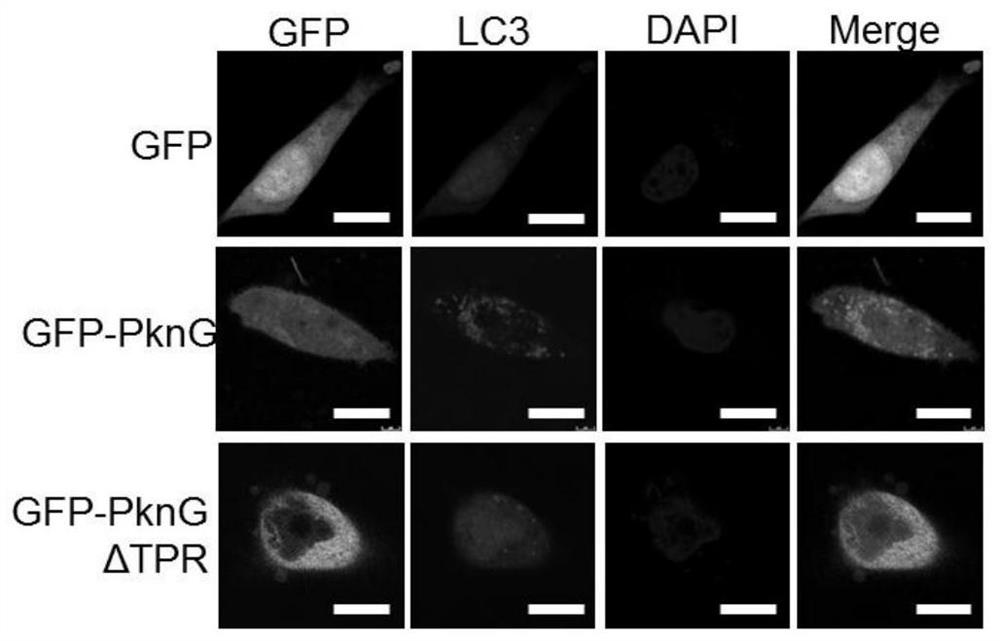 A target of anti-tuberculosis mycobacterium and its application