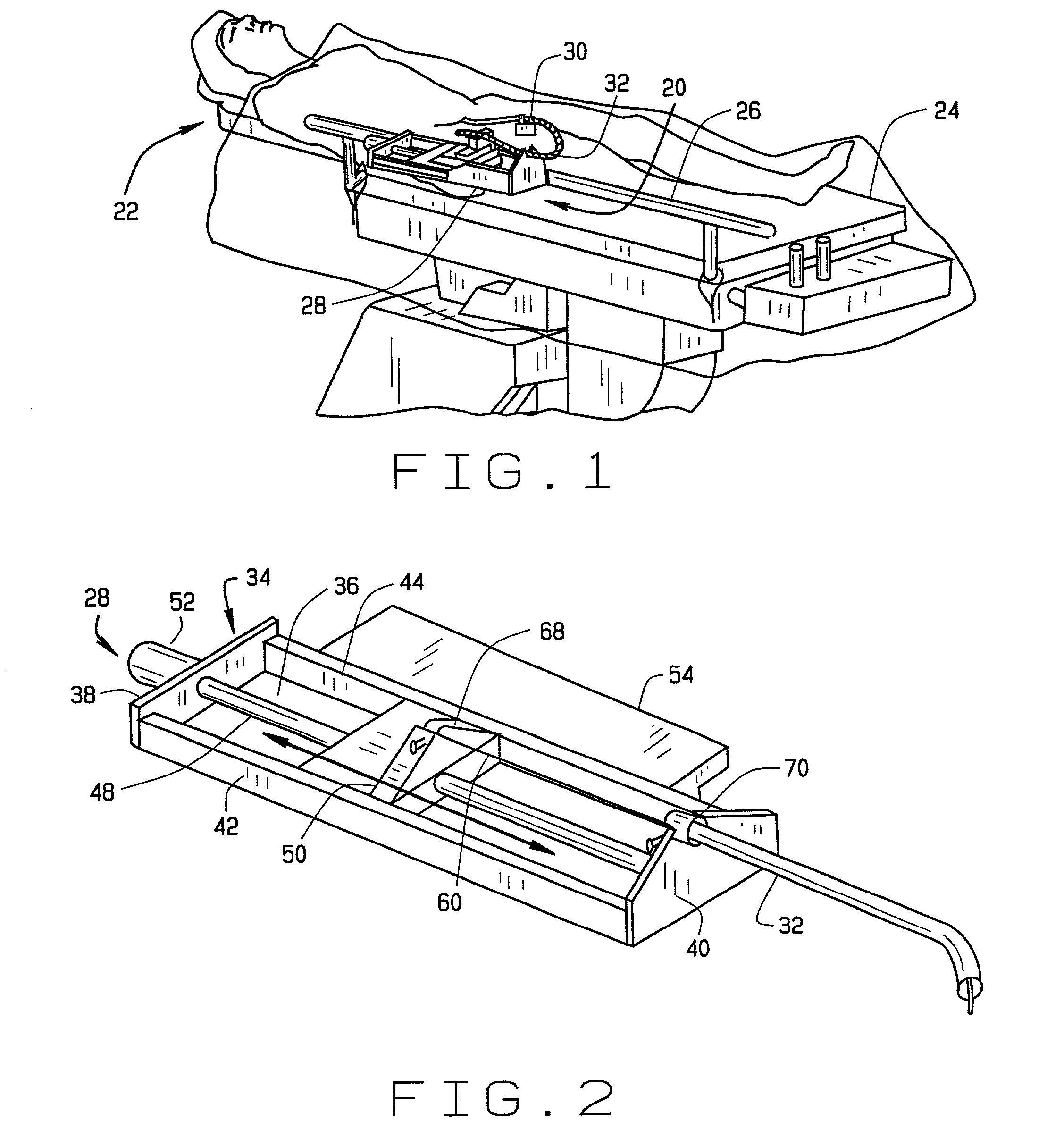System and methods for advancing a catheter