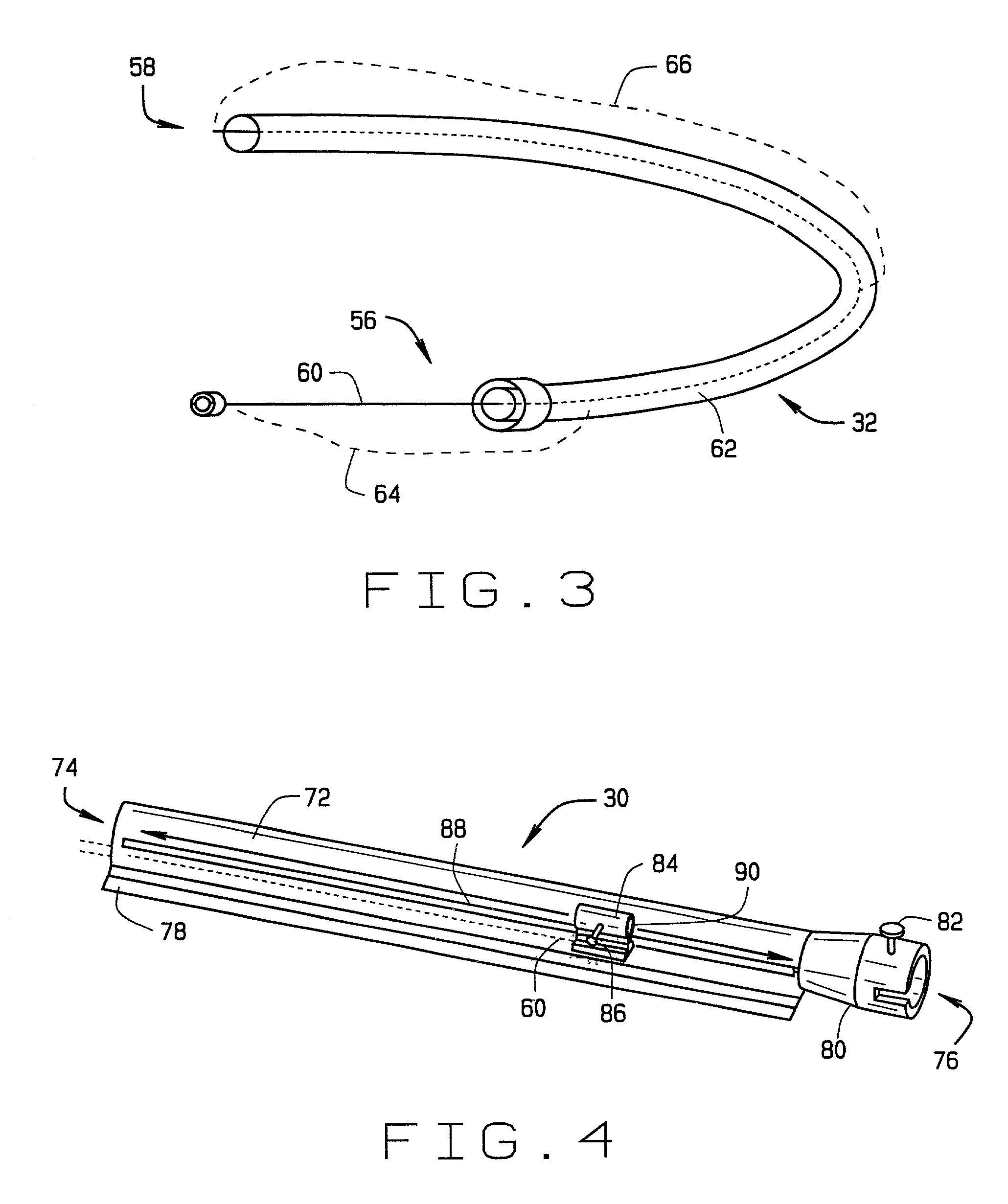 System and methods for advancing a catheter