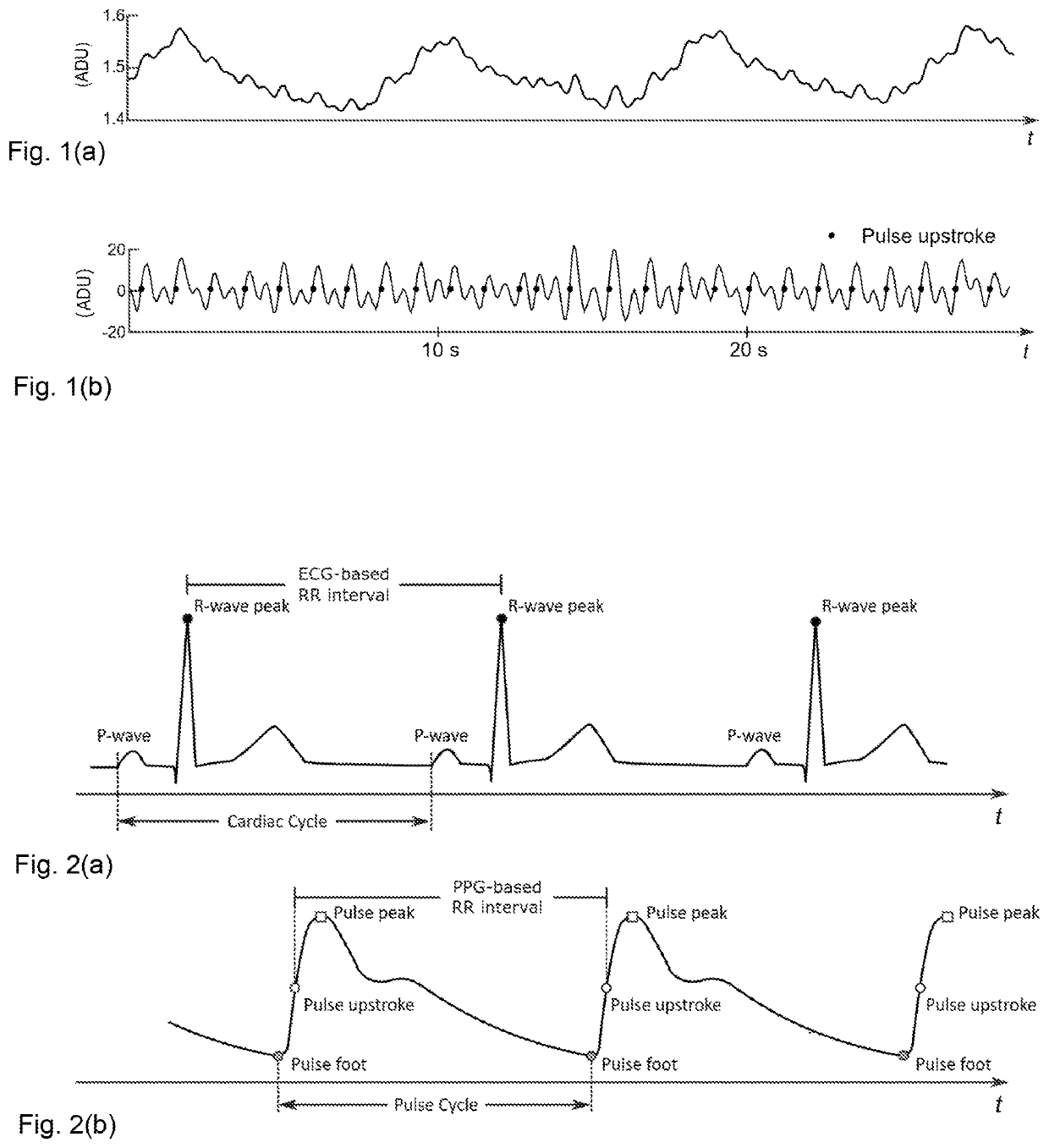 Method for classifying photoplethysmography pulses and monitoring of cardiac arrhythmias