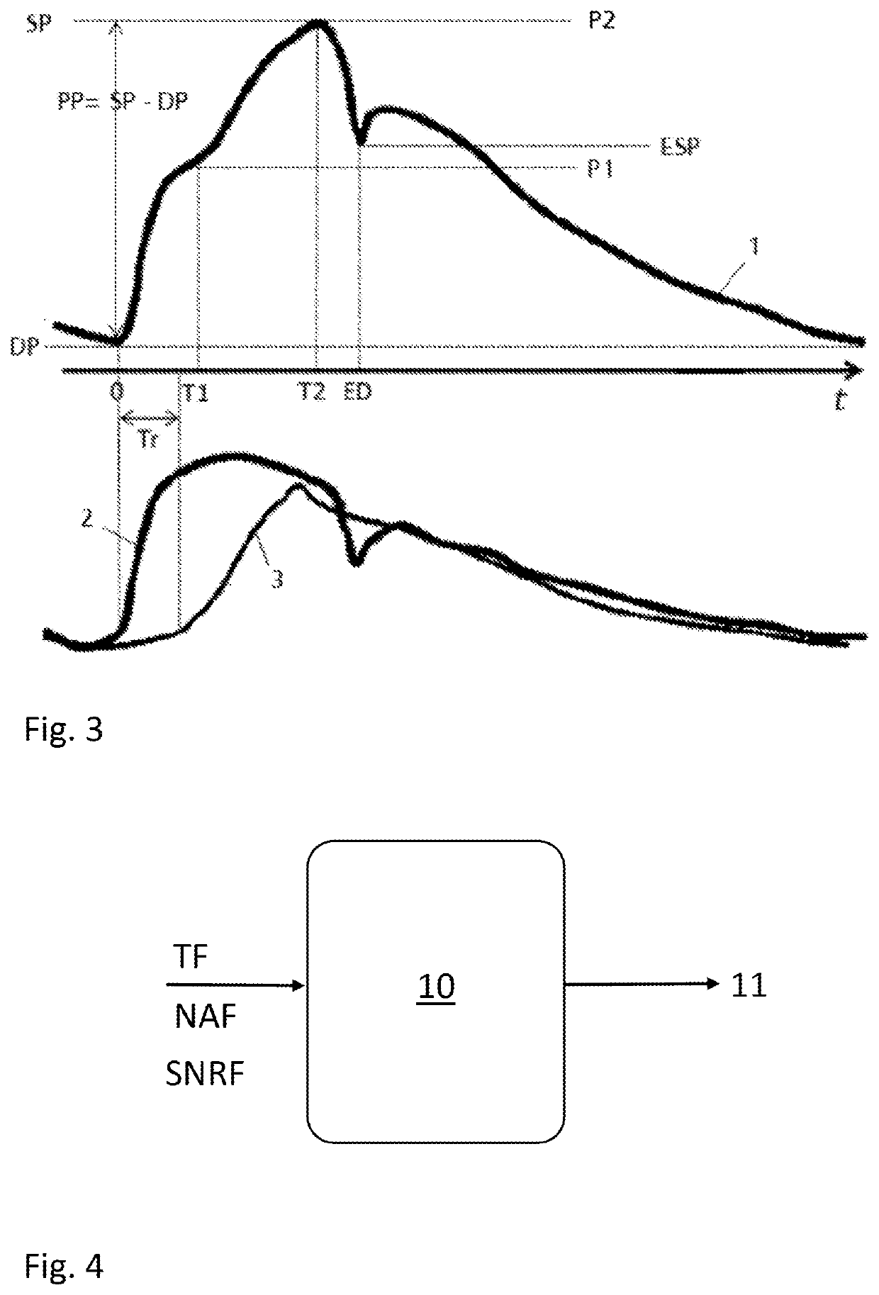 Method for classifying photoplethysmography pulses and monitoring of cardiac arrhythmias