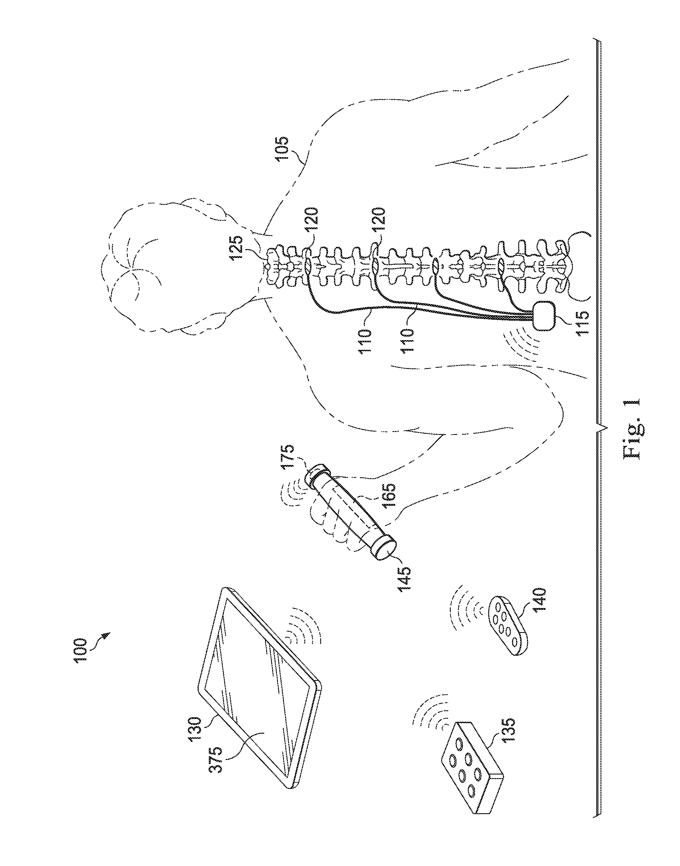 System and method of performing computer assisted stimulation programming (CASP) with a non-zero starting value customized to a patient