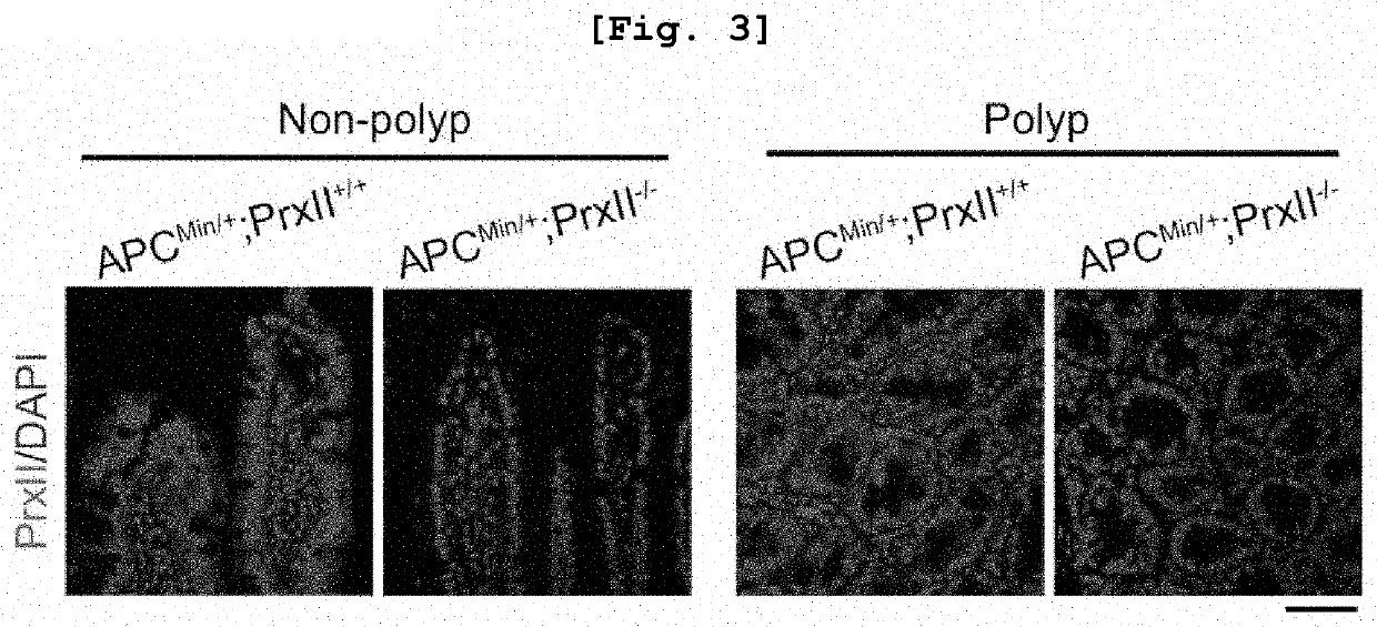 Pharmaceutical composition comprising substance inhibiting enzymatic activity of peroxiredoxin 2 as effective ingredient for treatment of colorectal cancer