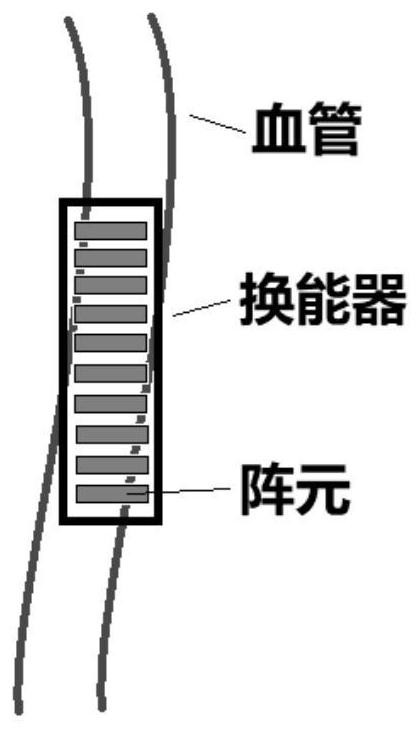 Wearable ultrasonic monitoring device