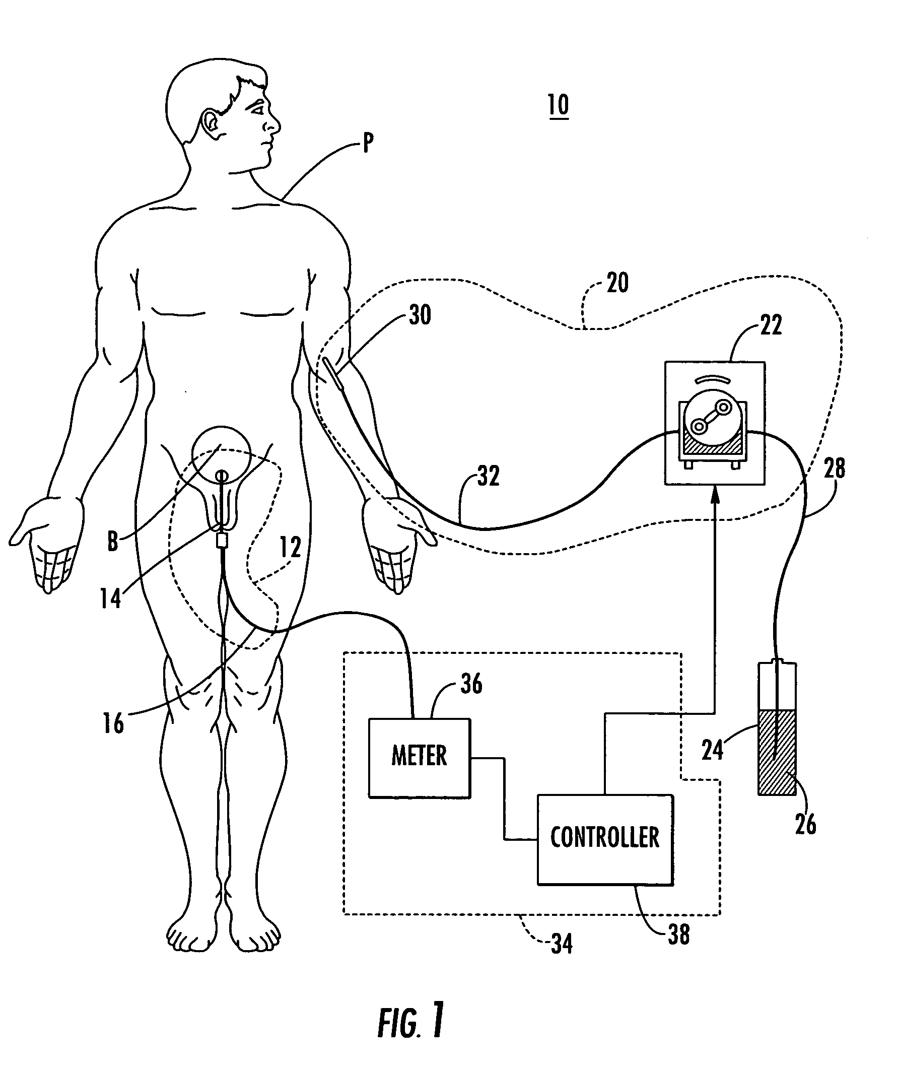 Patient hydration system and method