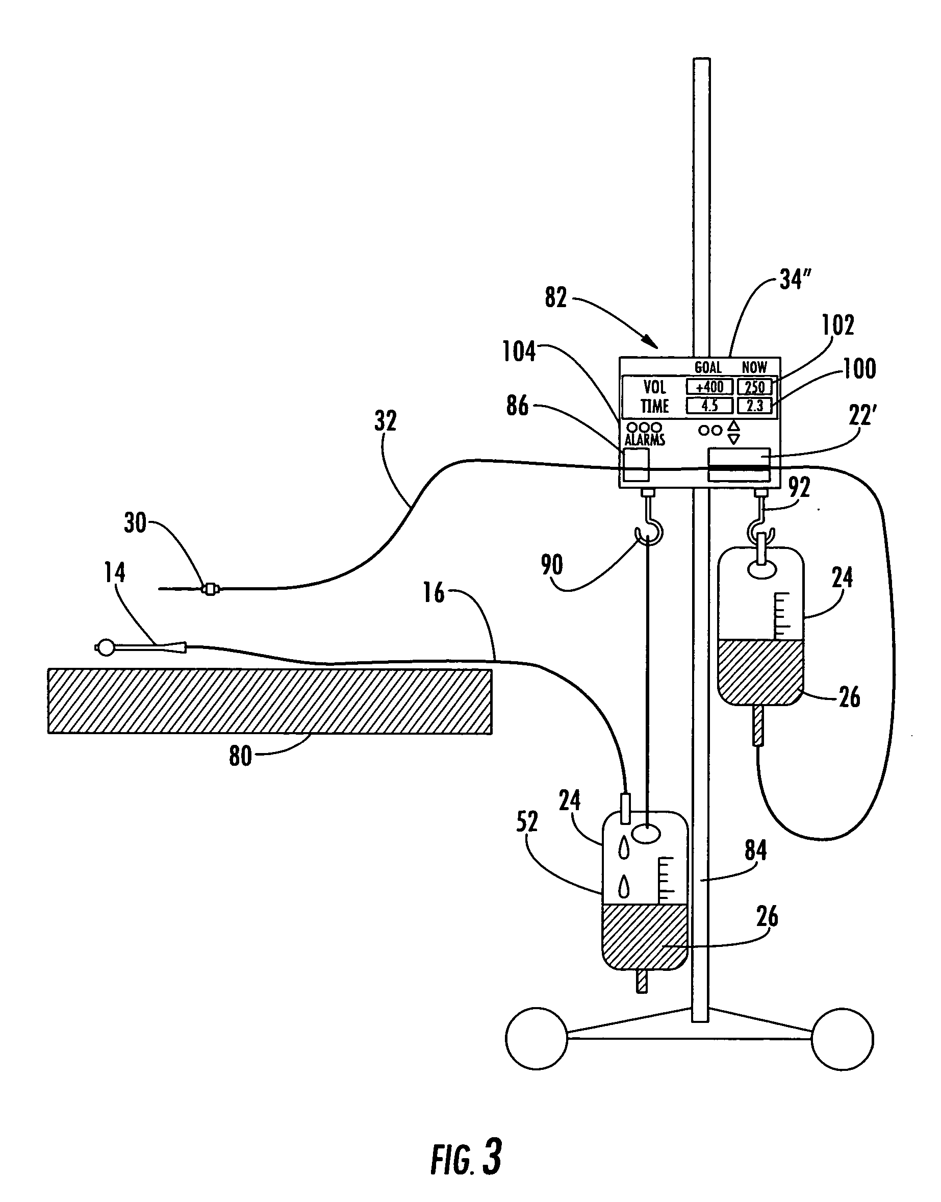 Patient hydration system and method