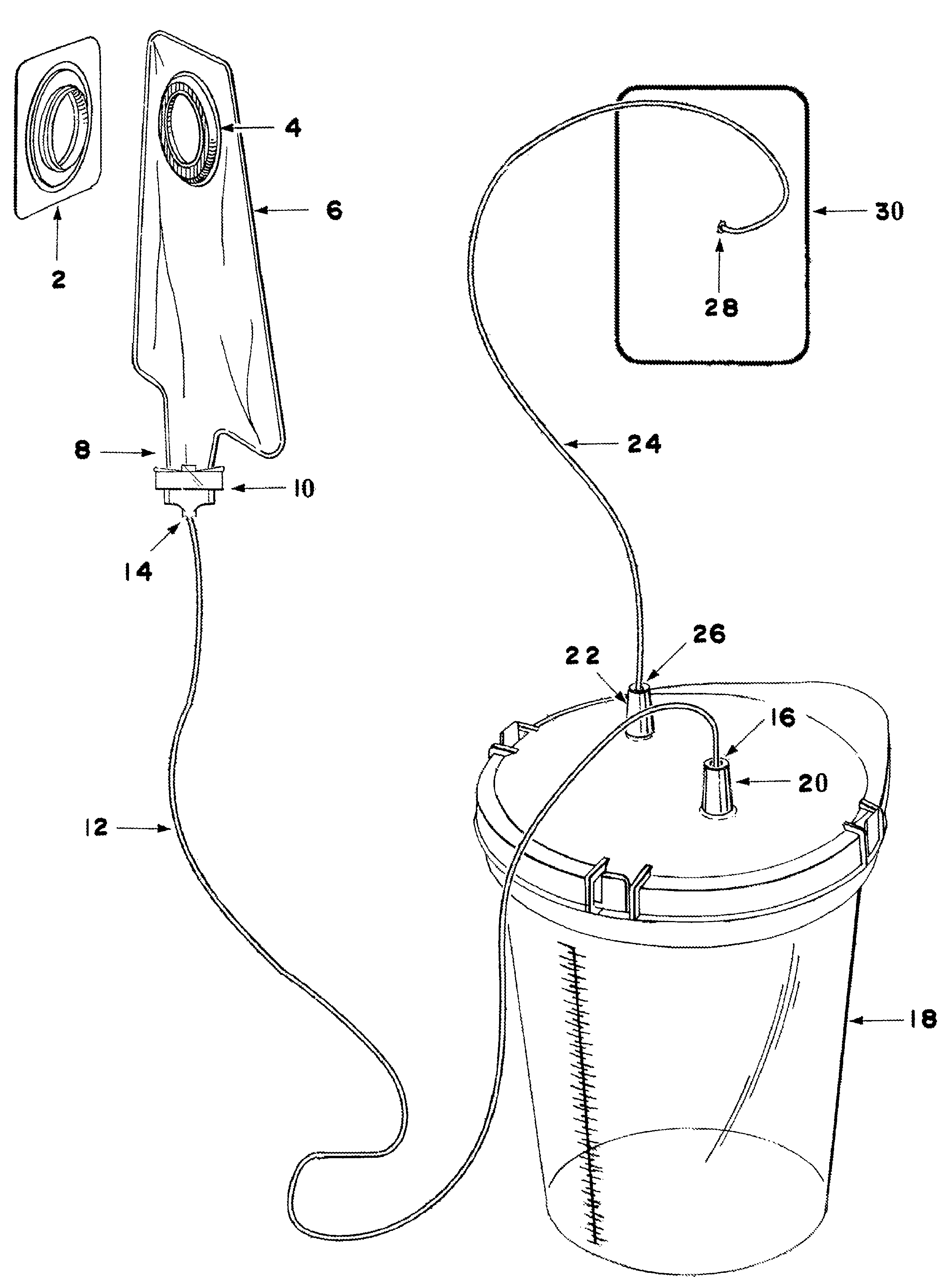 Ostomy suction system