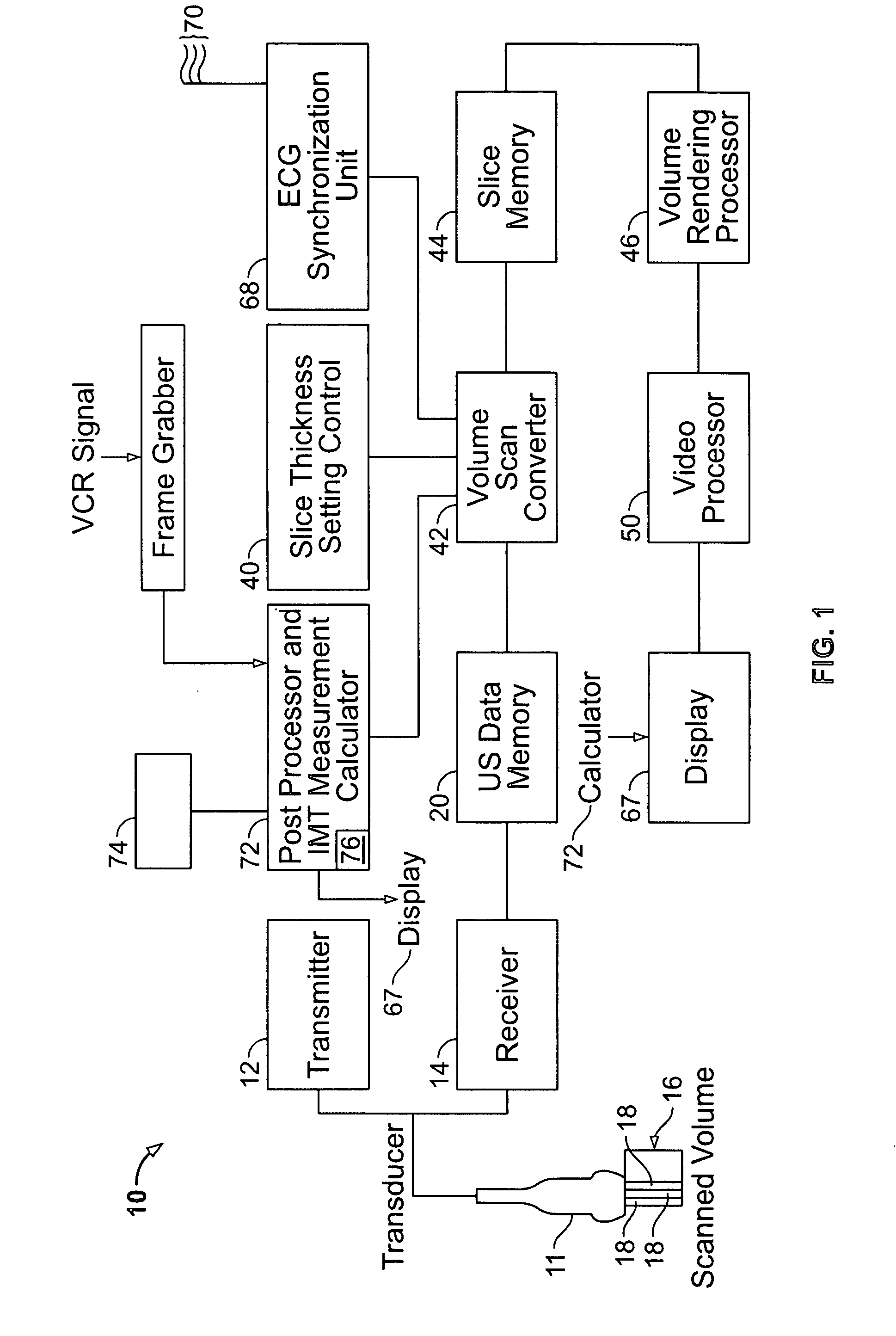 Method and apparatus for measuring anatomic structures
