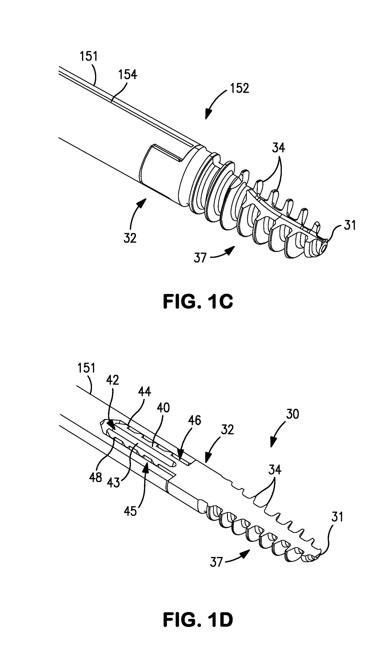 Bone joining apparatus and method