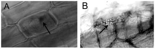 A dse fungus and a method for rapid mycorrhization of blueberry tissue cultured seedlings