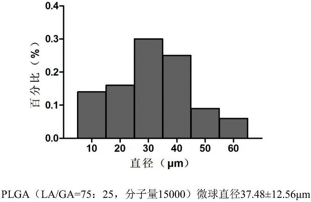 Temozolomide slow-release system as well as preparation method and application thereof