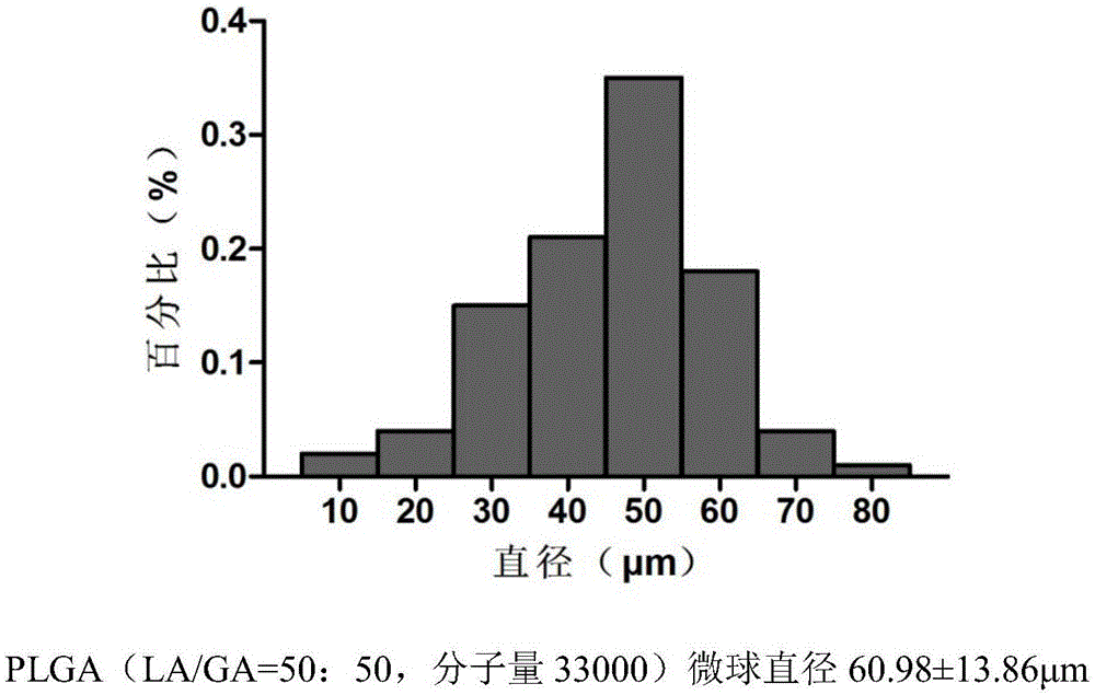 Temozolomide slow-release system as well as preparation method and application thereof