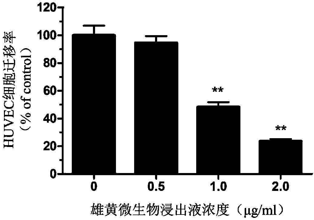 Application of realgar microbiological leaching liquid in preparation of drug for inhibiting angiogenesis