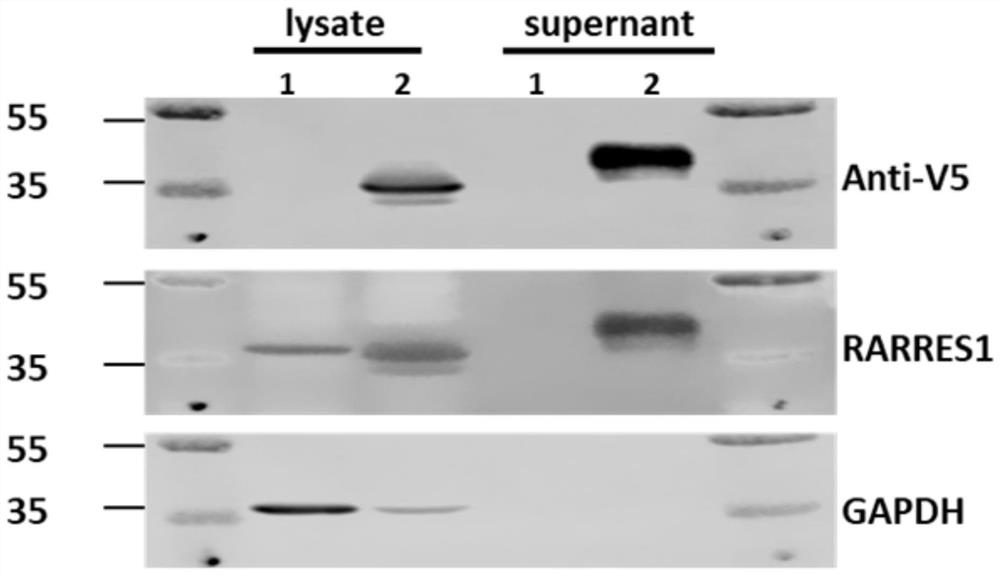 Application of retinoic acid receptor reactive protein 1 as a biomarker in chronic kidney disease