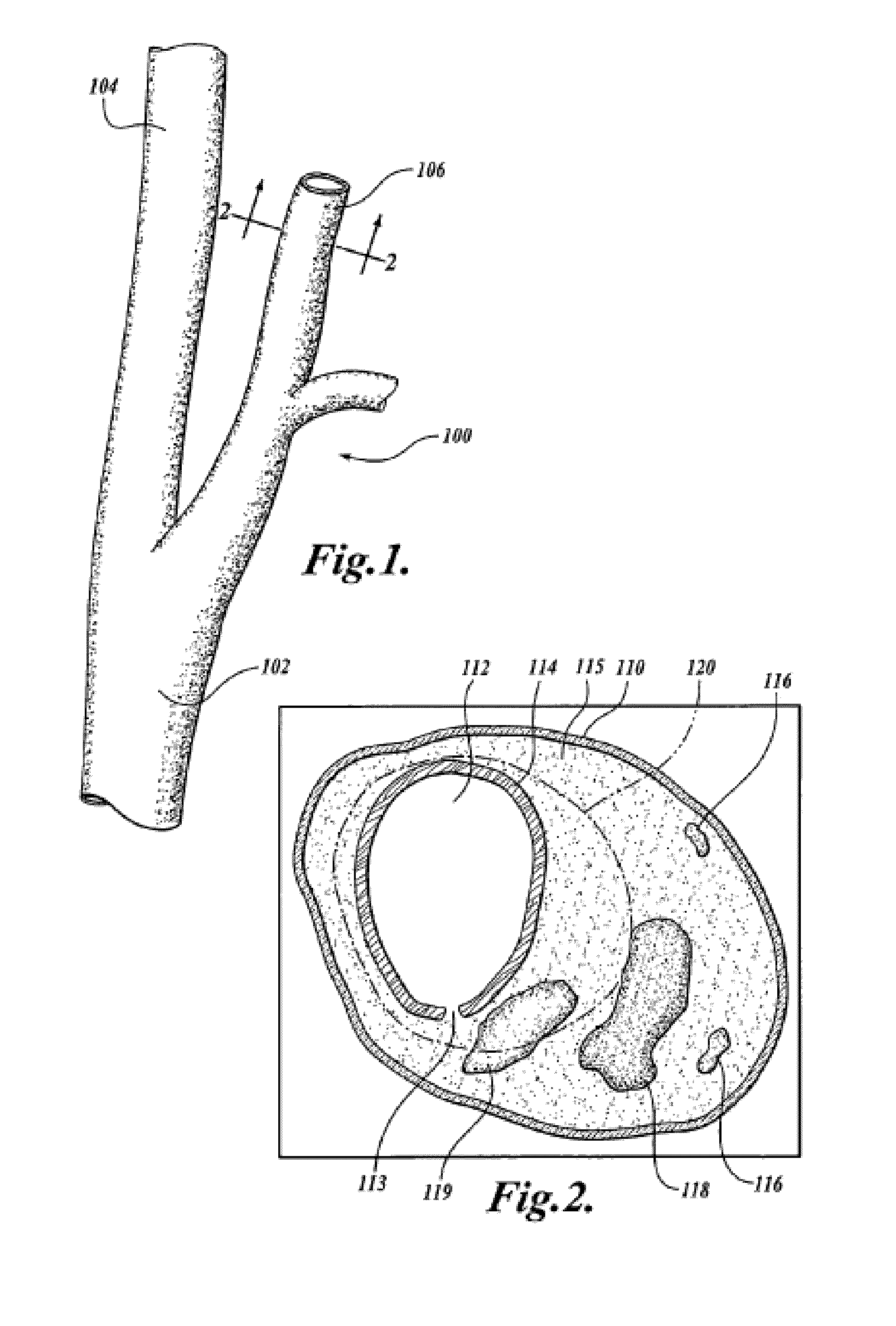 Method and System for Plaque Lesion Characterization