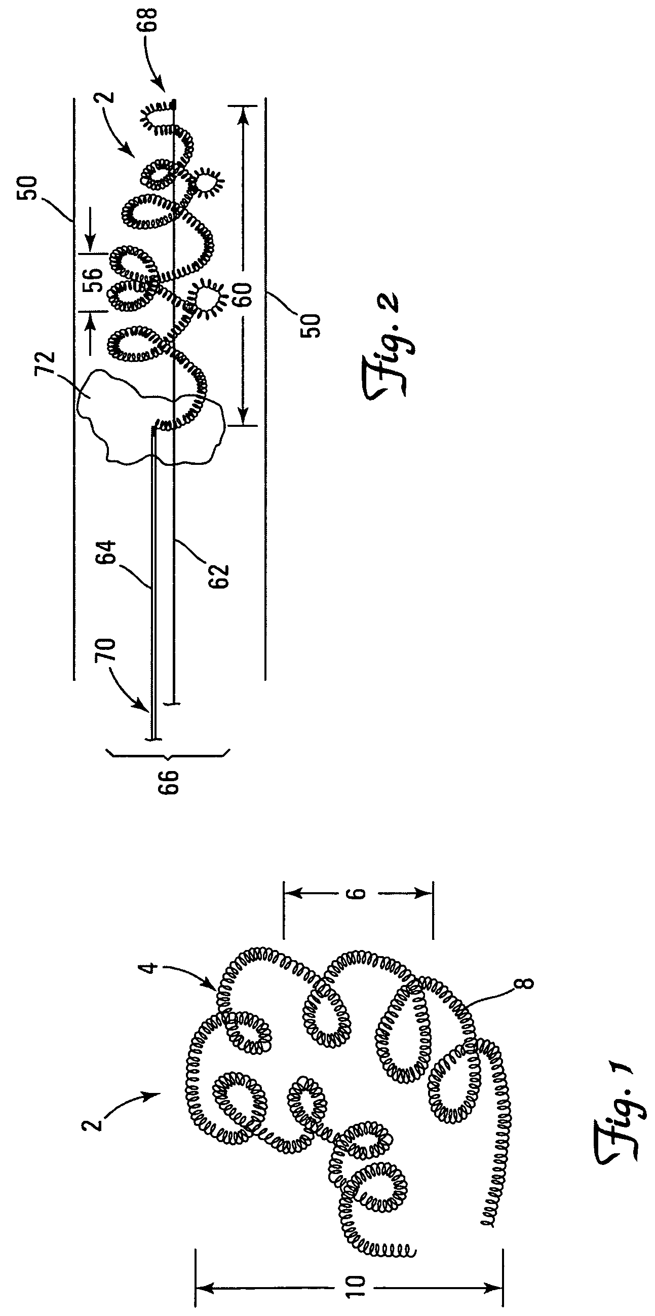 Thrombus removal system and process