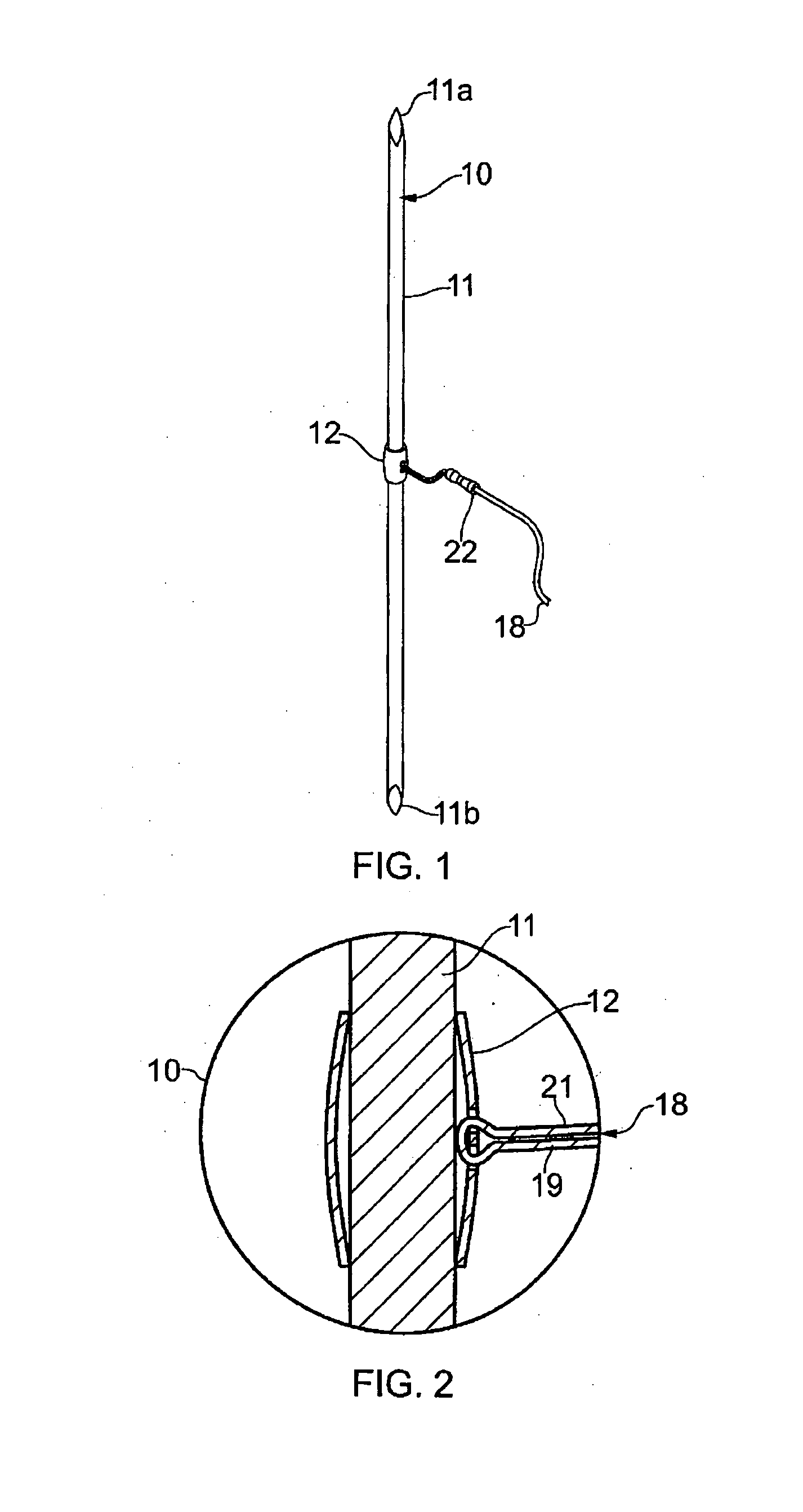 Suture Device