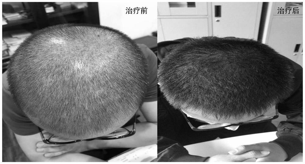 Traditional Chinese medicine composition for treating alopecia, traditional Chinese medicine preparation and preparation method thereof