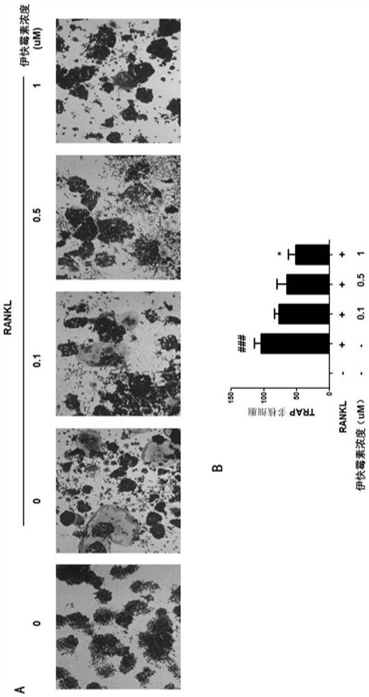 Application of Iquamycin in Preparation of Osteoclast Differentiation Inhibitor
