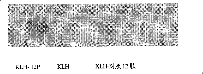Vaccine based on simulating human blood vessel endothelial cell growth factor VEGF epitope and preparation method thereof